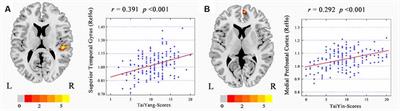 The Similarity Between Chinese Five-Pattern and Eysenck’s Personality Traits: Evidence From Theory and Resting-State fMRI